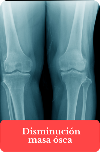 Pellets hormonas osteoporosis